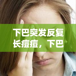 下巴突發(fā)反復(fù)長(zhǎng)痘痘，下巴突發(fā)性長(zhǎng)痘 