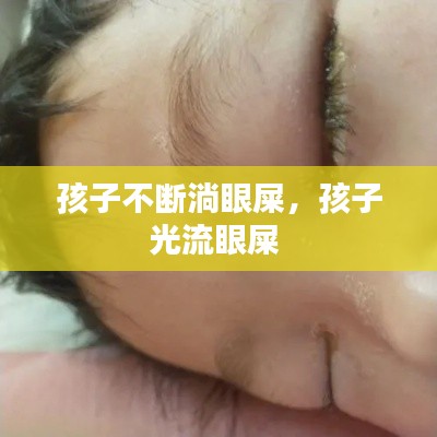 孩子不斷淌眼屎，孩子光流眼屎 